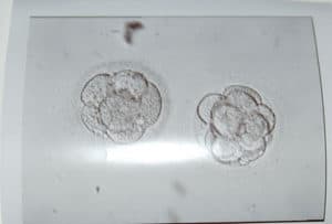 IVF embryos